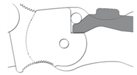 compresslock